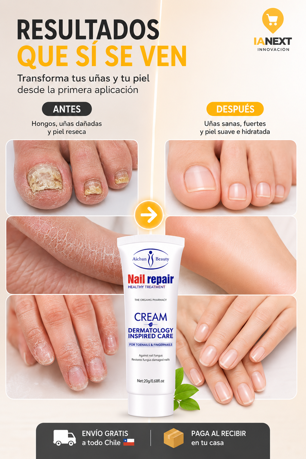 Crema Anti Hongos